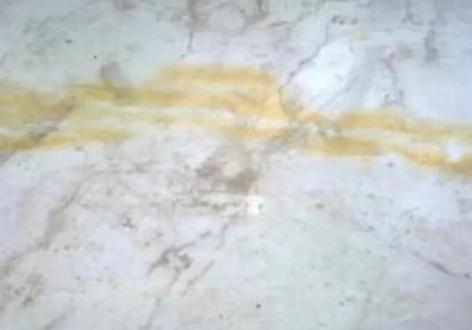 大理石病变处理